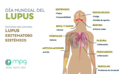 Día Mundial del Lupus