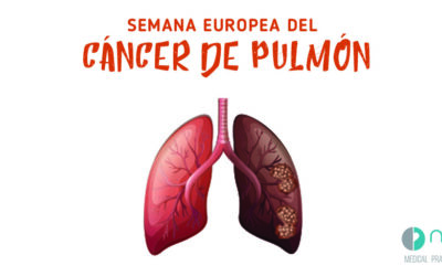 La segunda semana de septiembre se celebra la Semana Europea de Cáncer de Pulmón