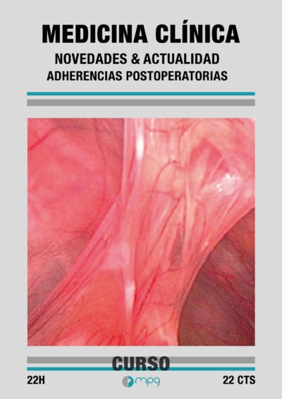 Actualización en Medicina Clínica 04: Adherencias Postoperatorias