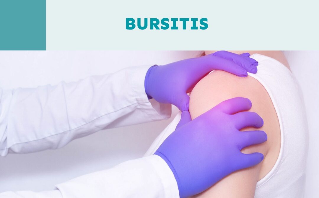 La bursitis, la gran olvidada de las dolencias articulares