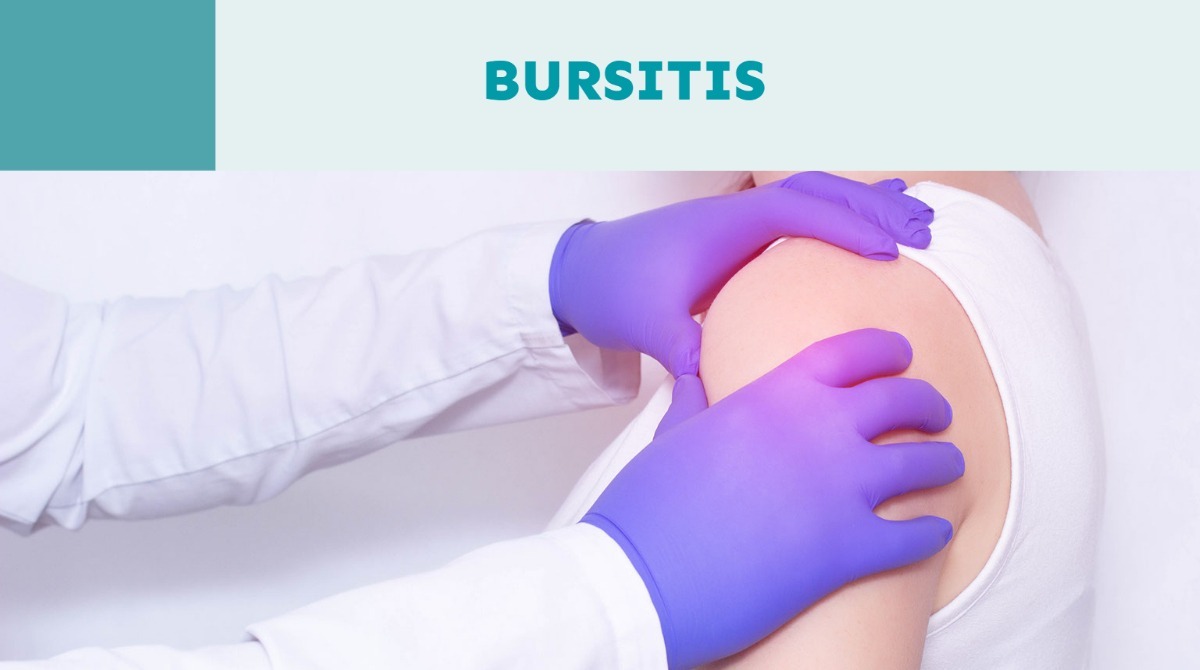 Lee más sobre el artículo La bursitis, la gran olvidada de las dolencias articulares