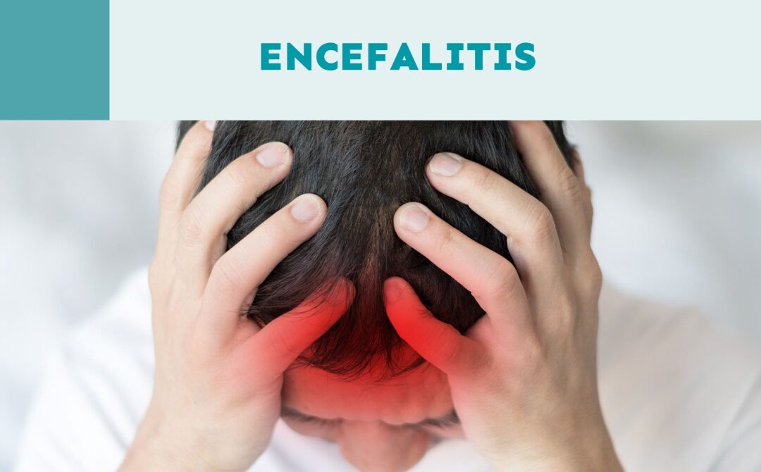 Encefalitis: Una enfermedad potencialmente mortal