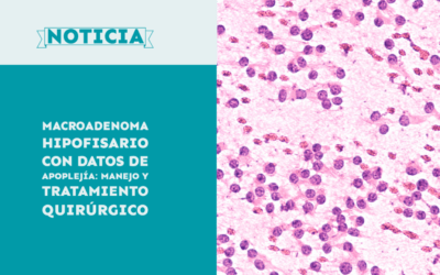 Macroadenoma hipofisario con datos de apoplejía: manejo y tratamiento quirúrgico